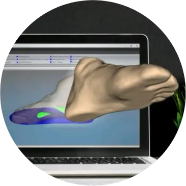 Tratamento - Palmilha 3D Sob Medida